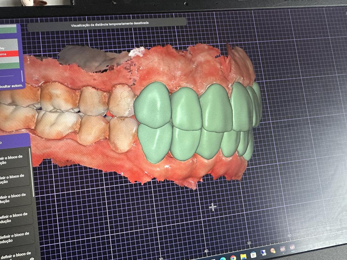 Design digital CAD de restaurações dentárias — Curso Chair Side Básico, Instituto Porto Smile