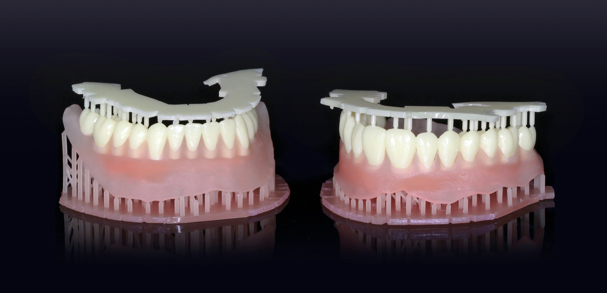Fluxo digital do módulo Exocad Full Denture na prática laboratorial