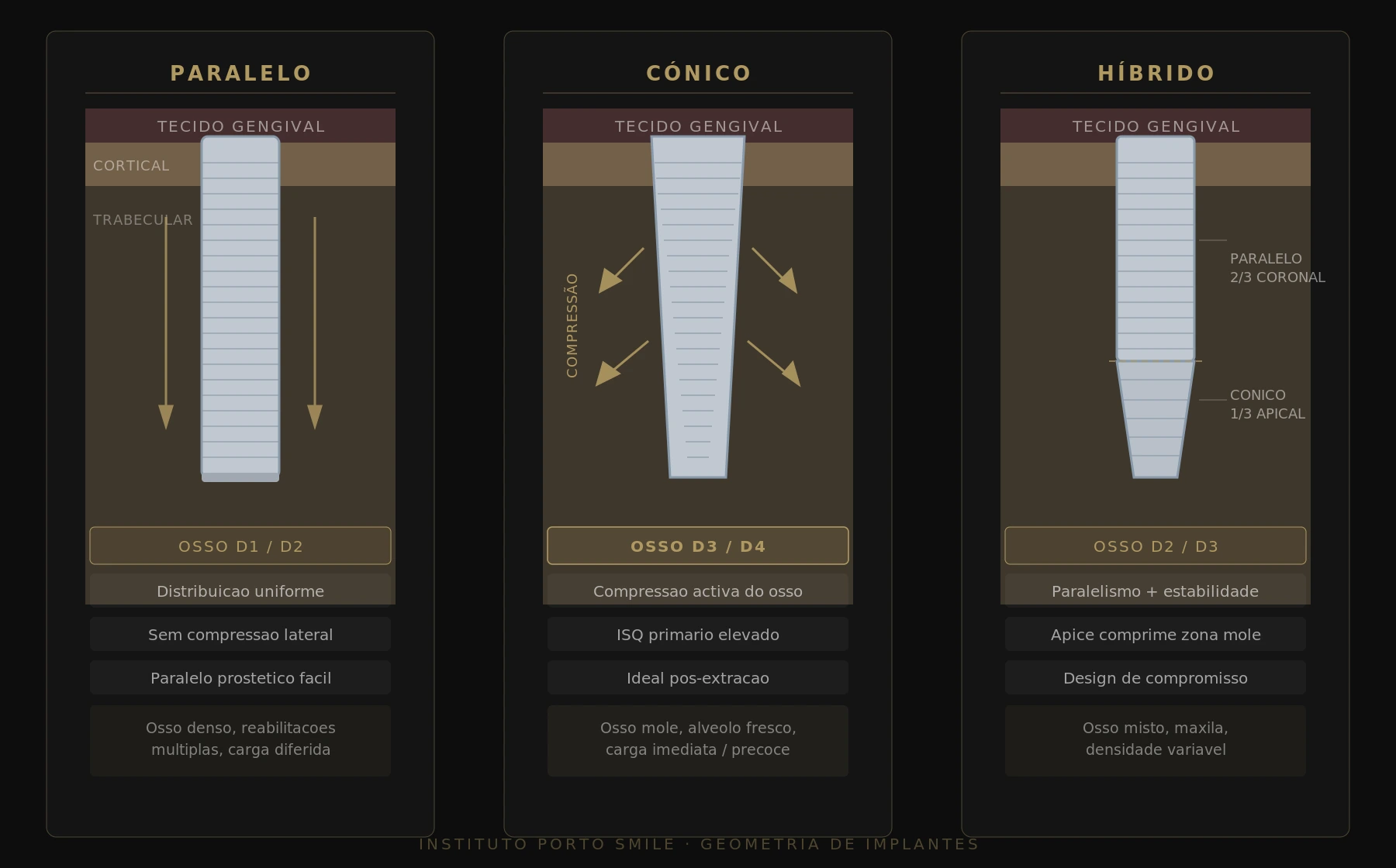 Comparação esquemática entre implante dentário de corpo paralelo e corpo cónico — distribuição de forças e compressão óssea