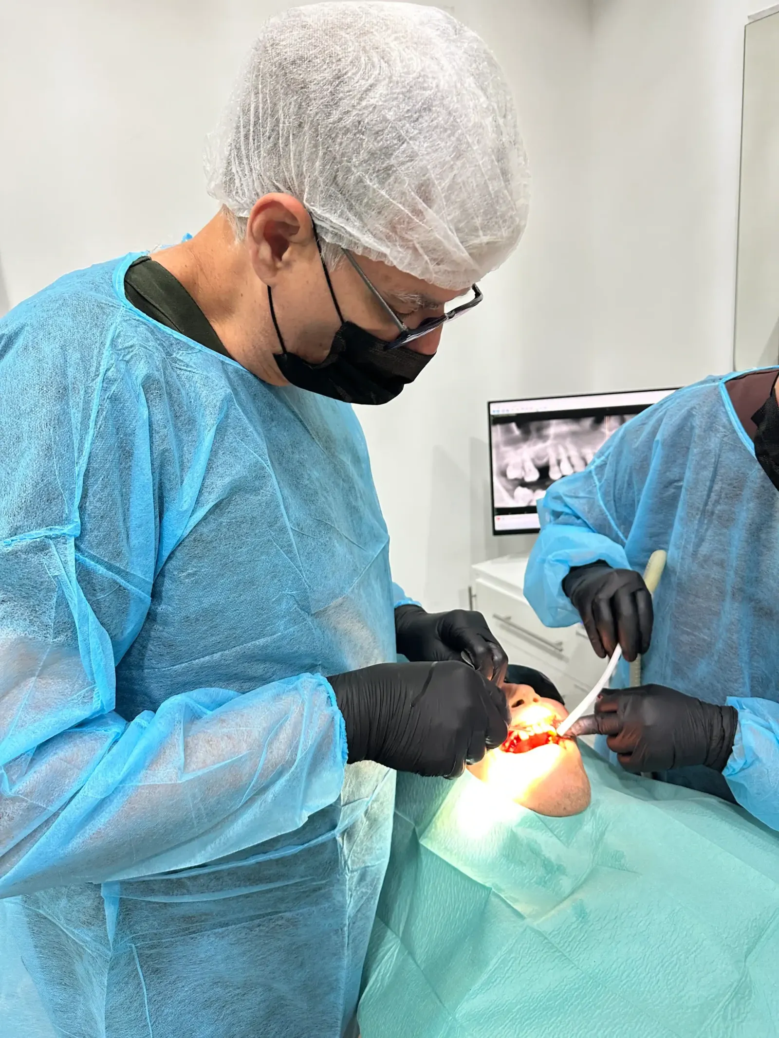 Cirurgia All-on-4 em curso — colocação guiada dos quatro implantes com transferência de posição, angulação e profundidade planeadas digitalmente